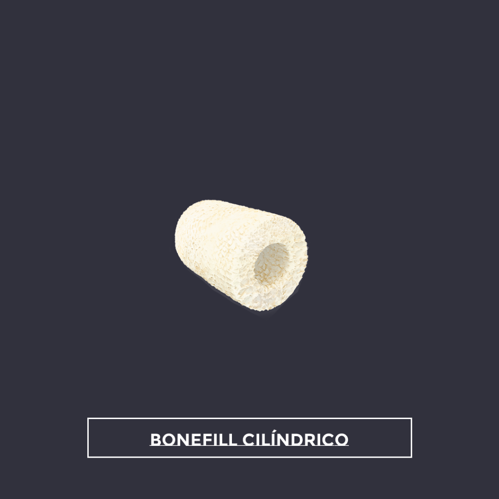 Bonefill cilindrico