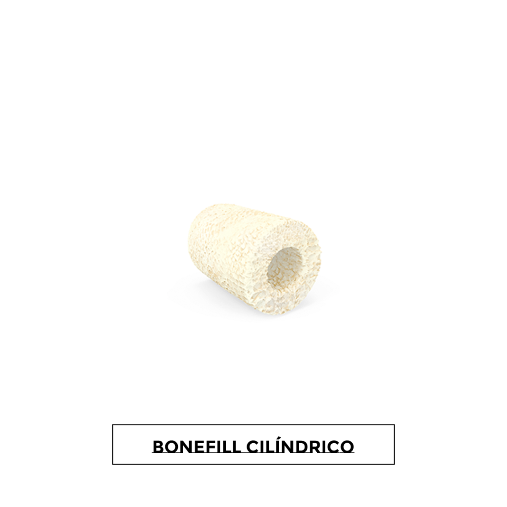 Bonefill Cilindrico 1