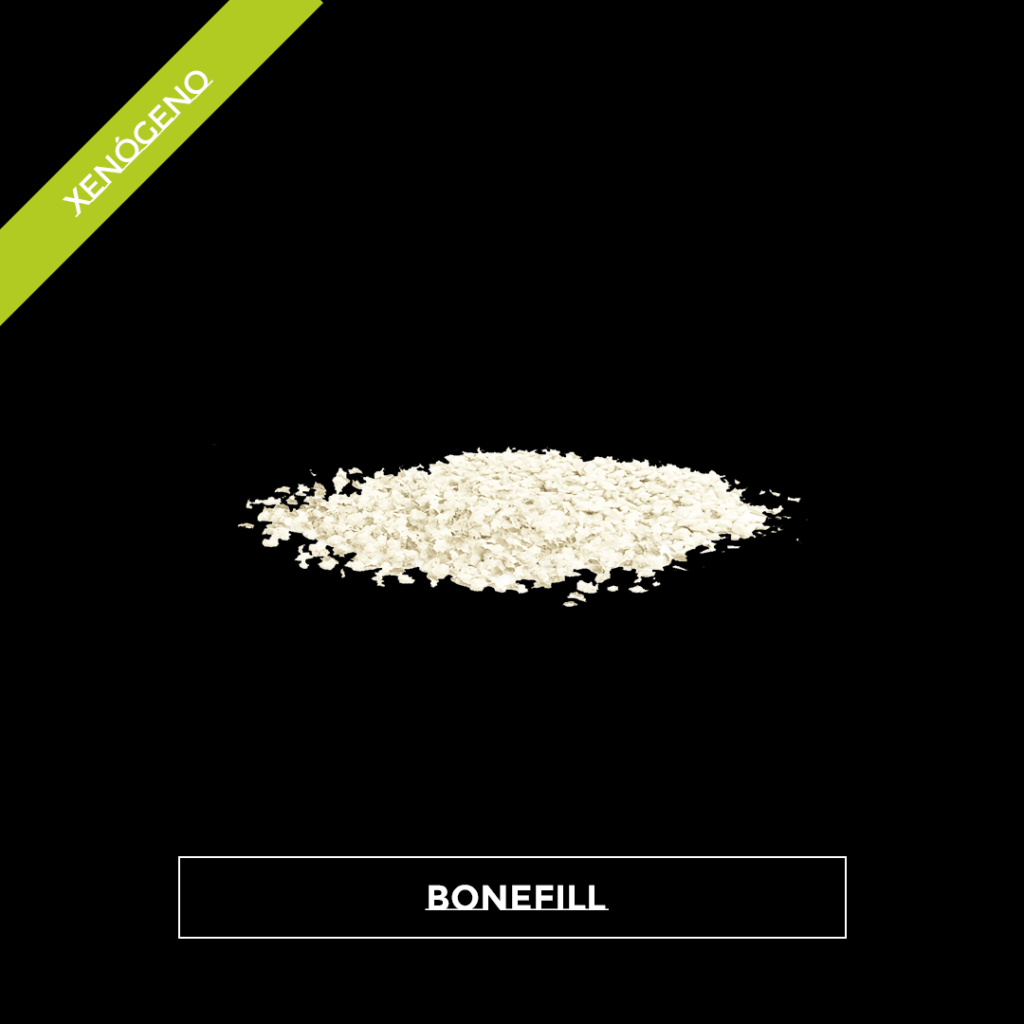 Bonefill